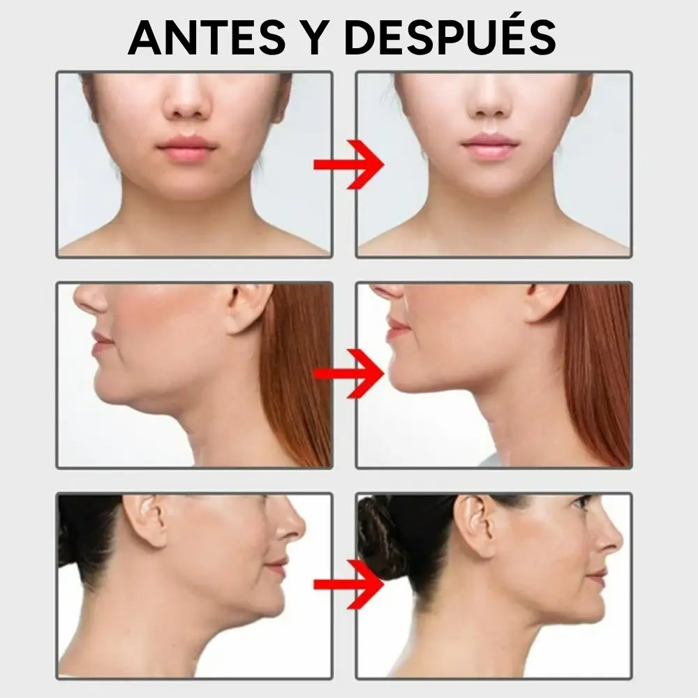 Cinta Invisible de Estiramiento Facial V-Shape™
