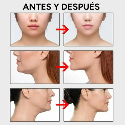 Cinta Invisible de Estiramiento Facial V-Shape™